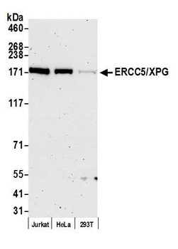 Rabbit ERCC5/XPG Antibody