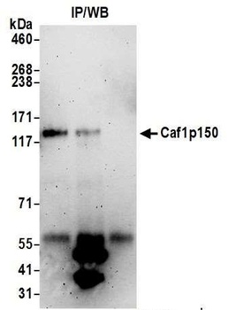 Rabbit Caf1p150 Antibody