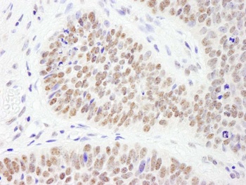 Rabbit anti-PHF6 Antibody
