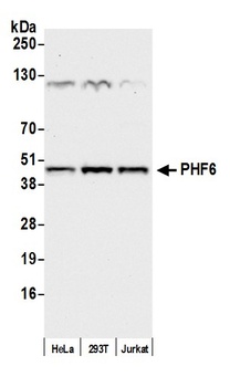 Rabbit anti-PHF6 Antibody