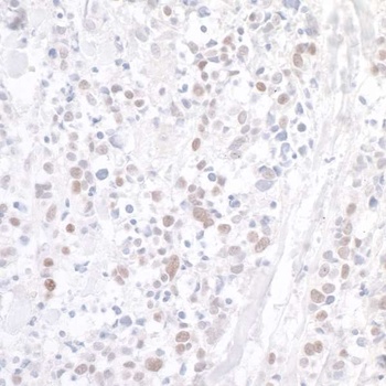 Rabbit WDR79 Antibody