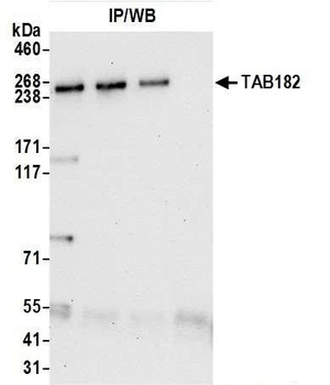 Rabbit TAB182 Antibody