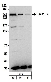 Rabbit TAB182 Antibody