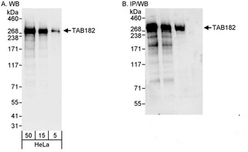 Rabbit TAB182 Antibody