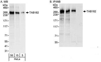 Rabbit TAB182 Antibody