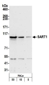 Rabbit SART1 Antibody