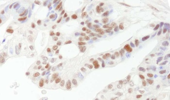 Rabbit DFF45/DFFA Antibody