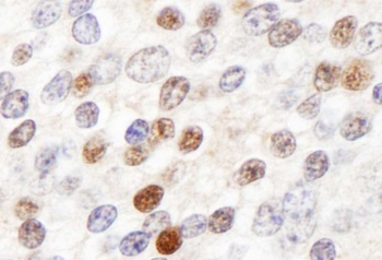 Rabbit ZHX3 Antibody