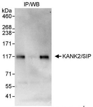 Rabbit KANK2/SIP Antibody