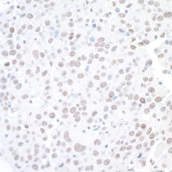 Rabbit BAF53A Antibody