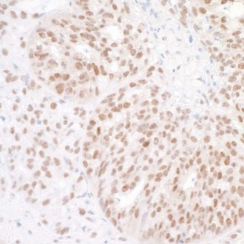 Rabbit BAF53A Antibody