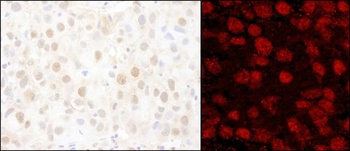 Rabbit PARP1 Antibody