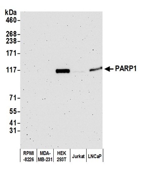 Rabbit PARP1 Antibody