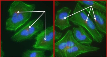 Rabbit Pericentrin/Kendrin Antibody
