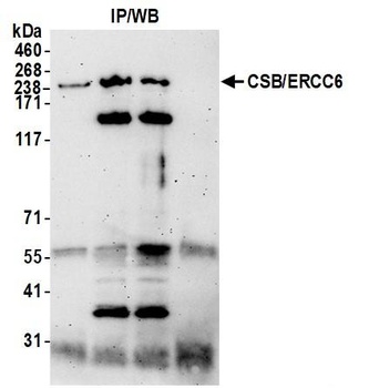 Rabbit anti-CSB/ERCC6 Antibody