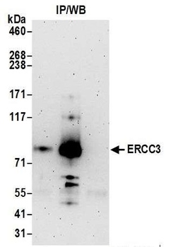 Rabbit anti-ERCC3 Antibody