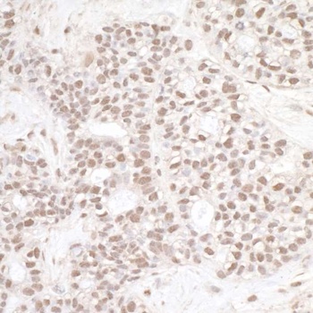 Rabbit anti-ERCC3 Antibody