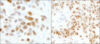 Rabbit GTF2I/TFII-I Antibody