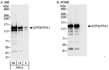 Rabbit GTF2I/TFII-I Antibody