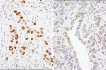 Rabbit GTF2I/TFII-I Antibody