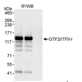 Rabbit GTF2I/TFII-I Antibody