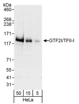 Rabbit GTF2I/TFII-I Antibody