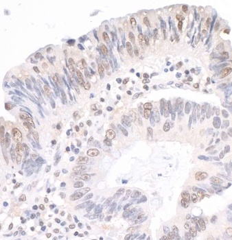 Rabbit MYBBP1A Antibody
