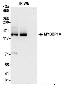 Rabbit MYBBP1A Antibody