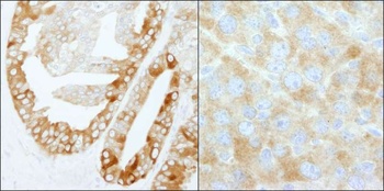 Rabbit FASN Antibody