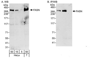 Rabbit FASN Antibody
