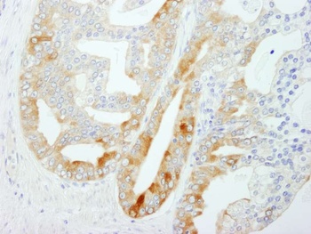 Rabbit FASN Antibody