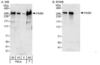 Rabbit FASN Antibody