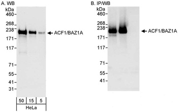 Rabbit ACF1/BAZ1A Antibody