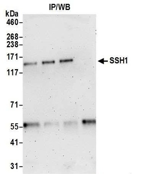 Rabbit SSH1 Antibody
