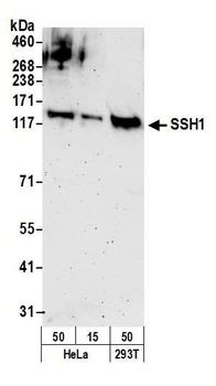 Rabbit SSH1 Antibody