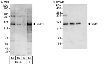 Rabbit SSH1 Antibody