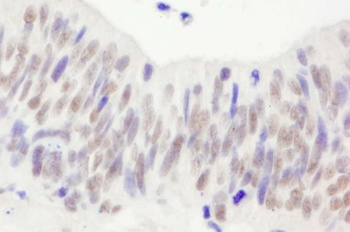 Rabbit NBS1 Antibody