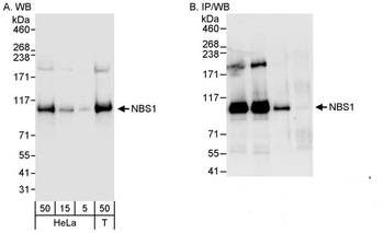 Rabbit NBS1 Antibody