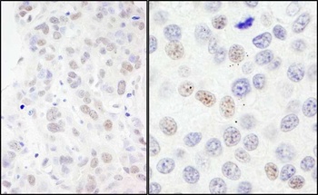 Rabbit NBS1 Antibody