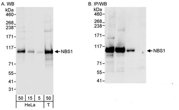 Rabbit NBS1 Antibody