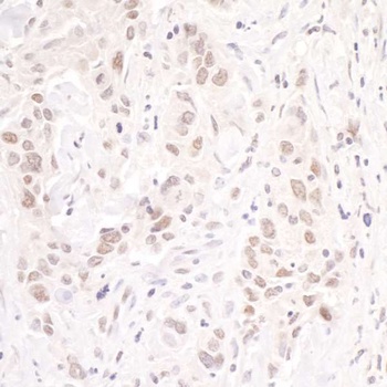 Rabbit p66beta/GATAD2B Antibody