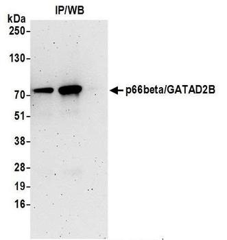 Rabbit p66beta/GATAD2B Antibody