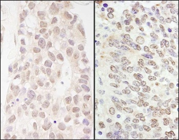 Rabbit p66beta/GATAD2B Antibody