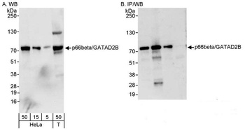 Rabbit p66beta/GATAD2B Antibody
