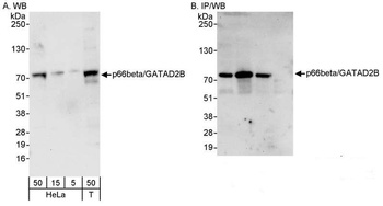 Rabbit p66beta/GATAD2B Antibody