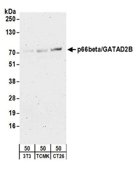 Rabbit p66beta/GATAD2B Antibody