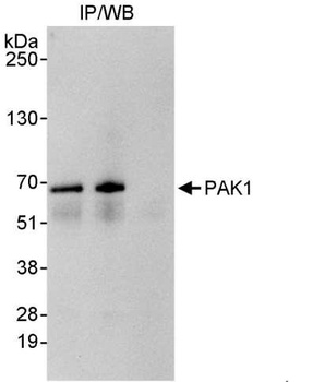 Rabbit PAK1 Antibody