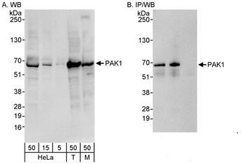 Rabbit PAK1 Antibody