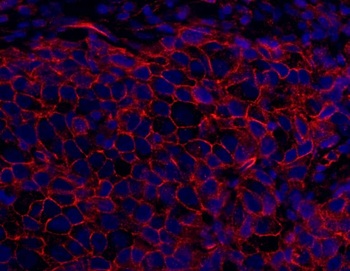 Rabbit SPTAN1/Alpha II-spectrin Antibody