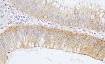 Rabbit SPTAN1/Alpha II-spectrin Antibody